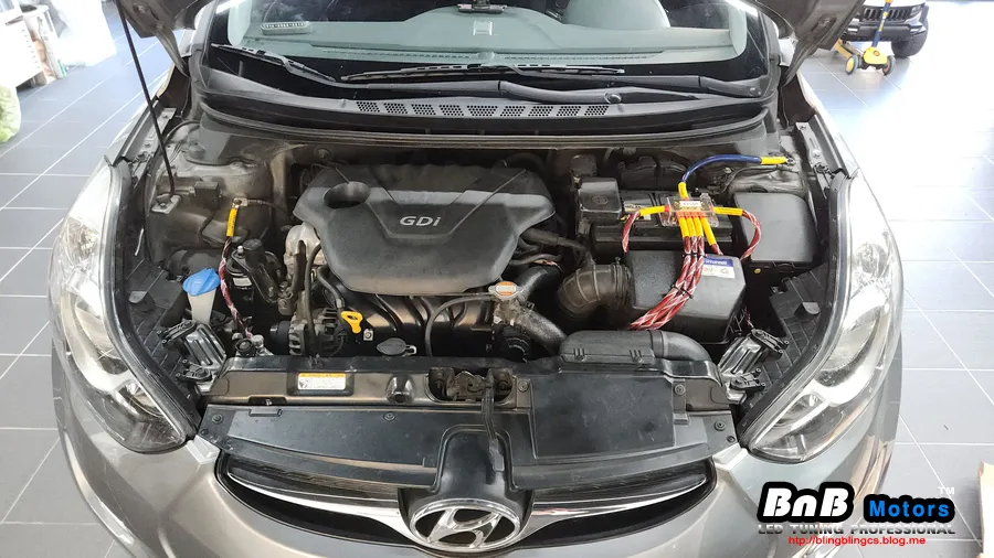 Hyundai Elantra MDのPPF施工事例|費用目安・仕上がり 施工写真 1-2