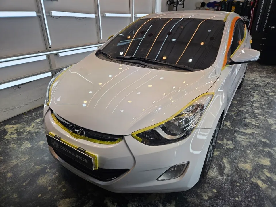 Hyundai Elantraのガラスコーティング事例|費用目安・仕上がり 施工写真 2-2
