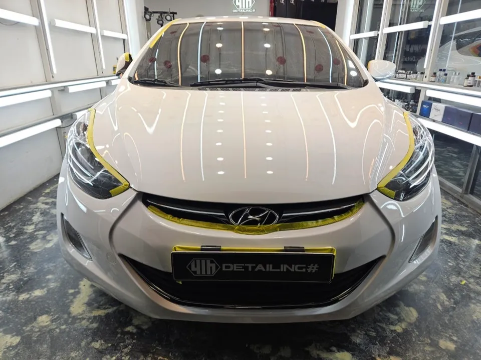 Hyundai Elantraのガラスコーティング事例|費用目安・仕上がり 施工写真 3-2