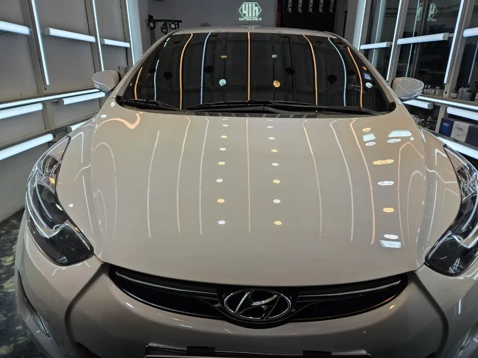 Hyundai Elantraのガラスコーティング事例|費用目安・仕上がり 施工写真 1-3