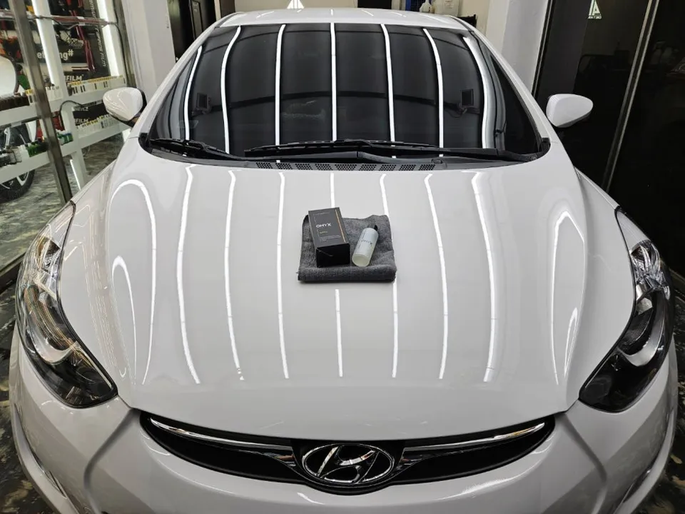 Hyundai Elantraのガラスコーティング事例|費用目安・仕上がり 施工写真 2-3