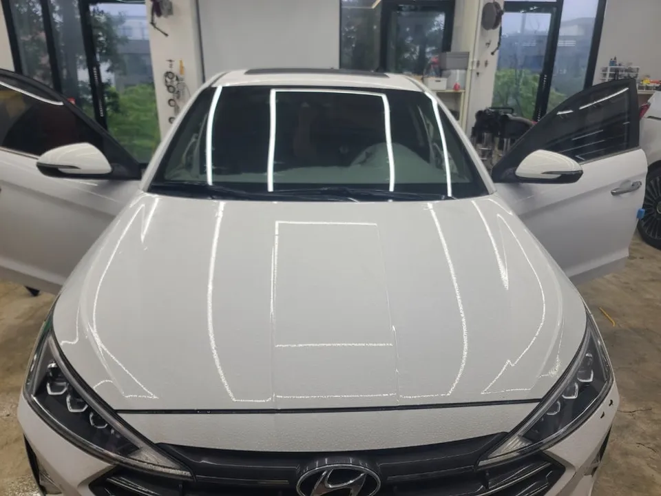 Hyundai Elantra PPF施工事例｜費用目安と仕上がり 写真