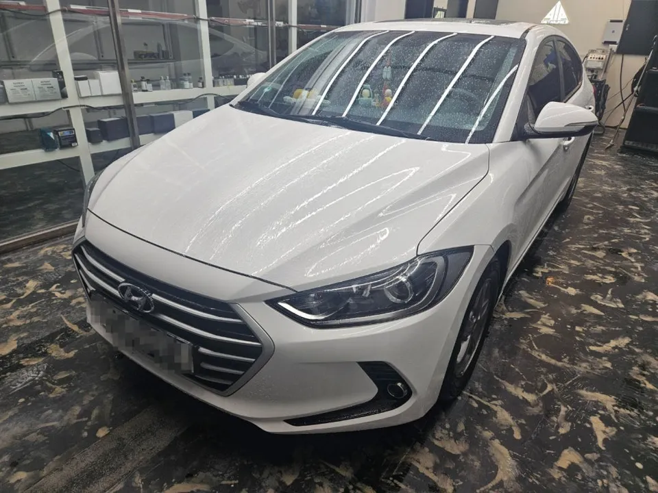 Hyundai Elantraのガラスコーティング事例|費用目安・仕上がり 施工写真 3-1