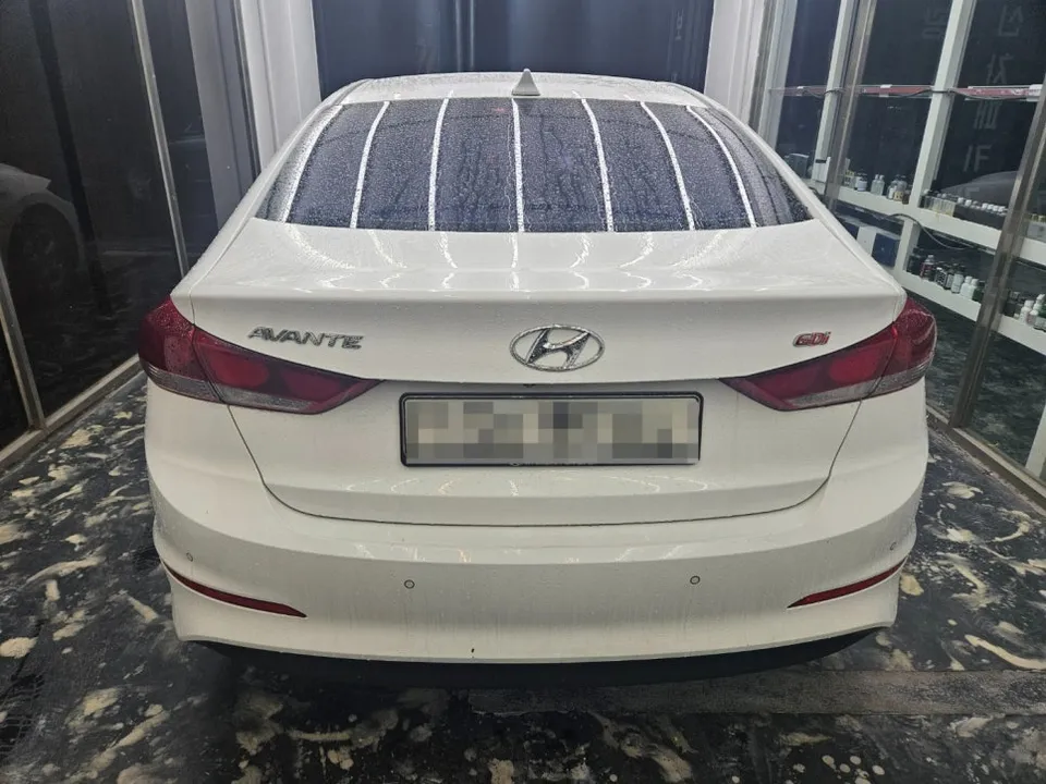 Hyundai Elantraのガラスコーティング事例|費用目安・仕上がり 施工写真 1-2