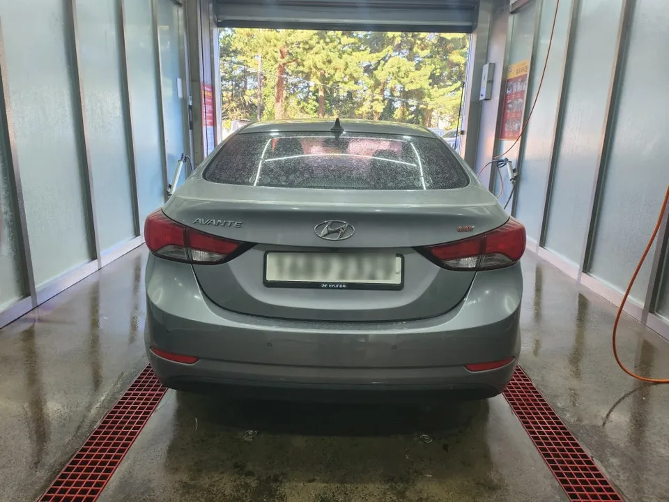 Hyundai ElantraのPPF施工事例|費用目安と仕上がり 施工写真 2-1