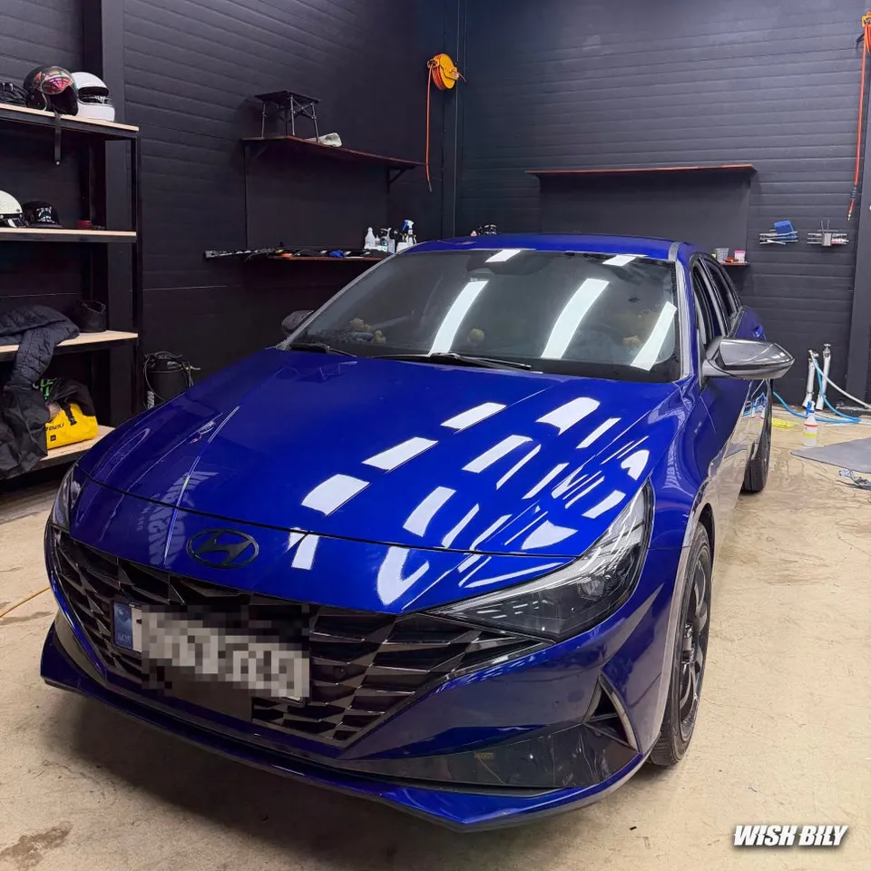 Hyundai Elantra PPF施工事例|費用目安・仕上がり 施工写真 1-2