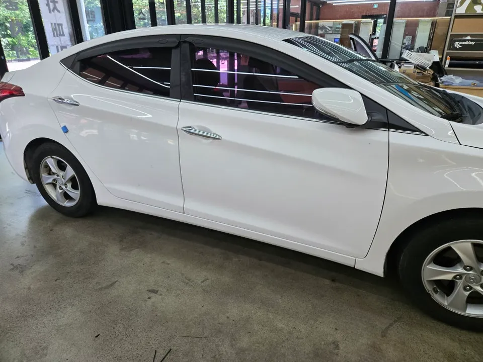 Hyundai ElantraのPPF施工事例|費用目安・仕上がり 施工写真 2-1